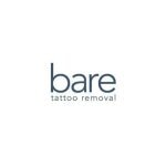 Bare Tattoo Removal